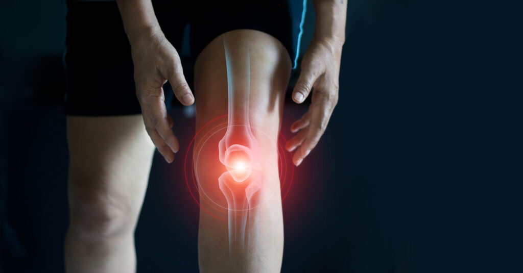 Advanced stem cell therapy for joint pain and orthopedic conditions at Nexus Clinic.