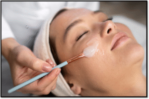 Chemical peels
