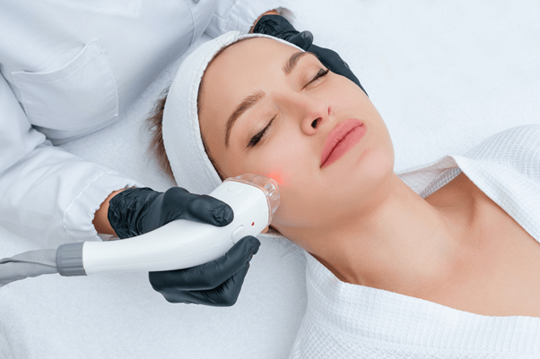 Laser skin treatment