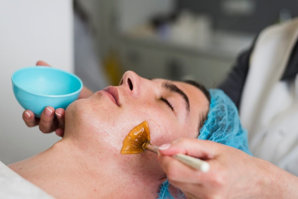 Chemical Peels Safety