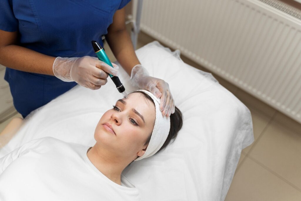 Laser Resurfacing