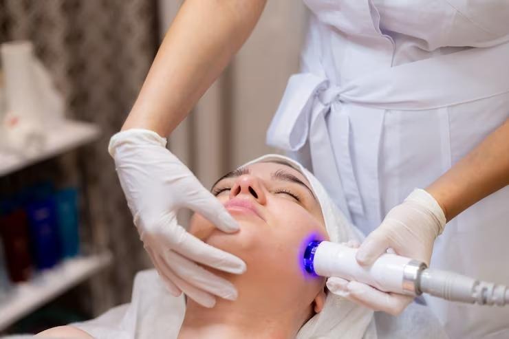 skin laser resurfacing