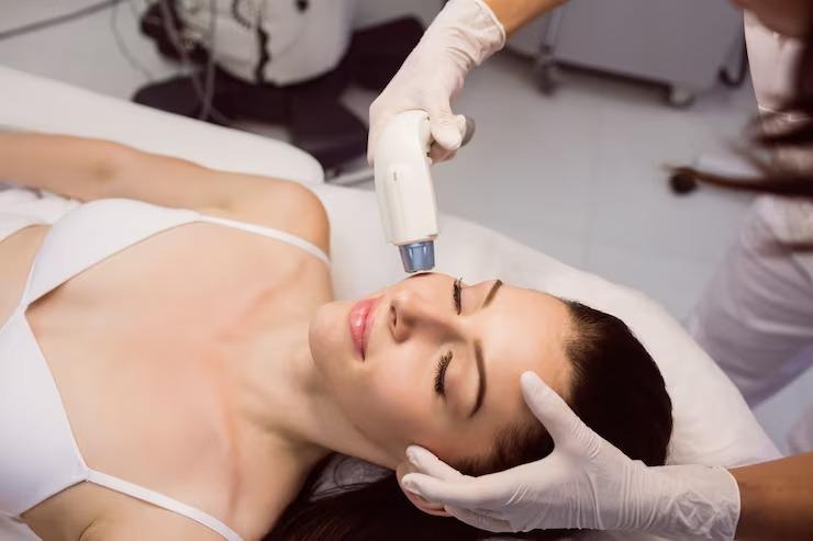 laser treatment for face scars